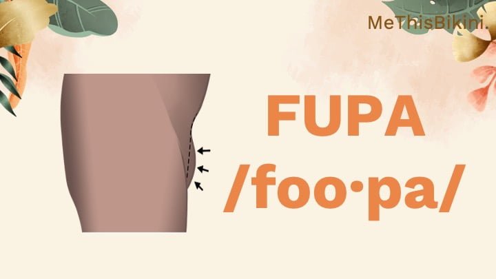 what is fupa